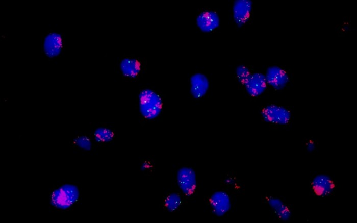 ?FISH熒光原位雜交技術(shù)與熒光顯微鏡