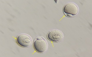 光學(xué)顯微鏡觀(guān)察方式大盤(pán)點(diǎn)：霍夫曼調(diào)制相襯