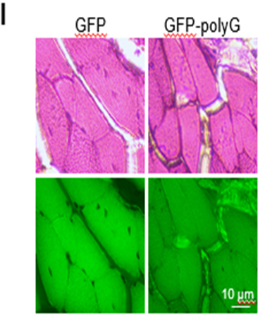 明美MIX60-FL助力上海科大科研團隊《Autophagy》發(fā)文揭示神經(jīng)退行性疾病新機制