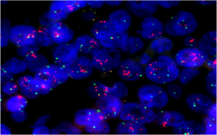 病毒“偵察兵”——揭秘疾控中心病毒實驗室的顯微鏡應用