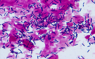 明美顯微鏡在疾控中心微生物檢測實驗室的應用